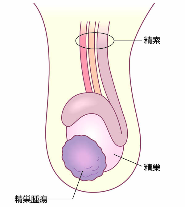 陰嚢 睾丸 キンタマの痛み 違和感 腫れ 痒み 東京泌尿器科クリニック上野