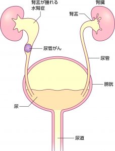 腰痛 背部痛について 腰が痛い 背中が痛い 東京泌尿器科クリニック上野